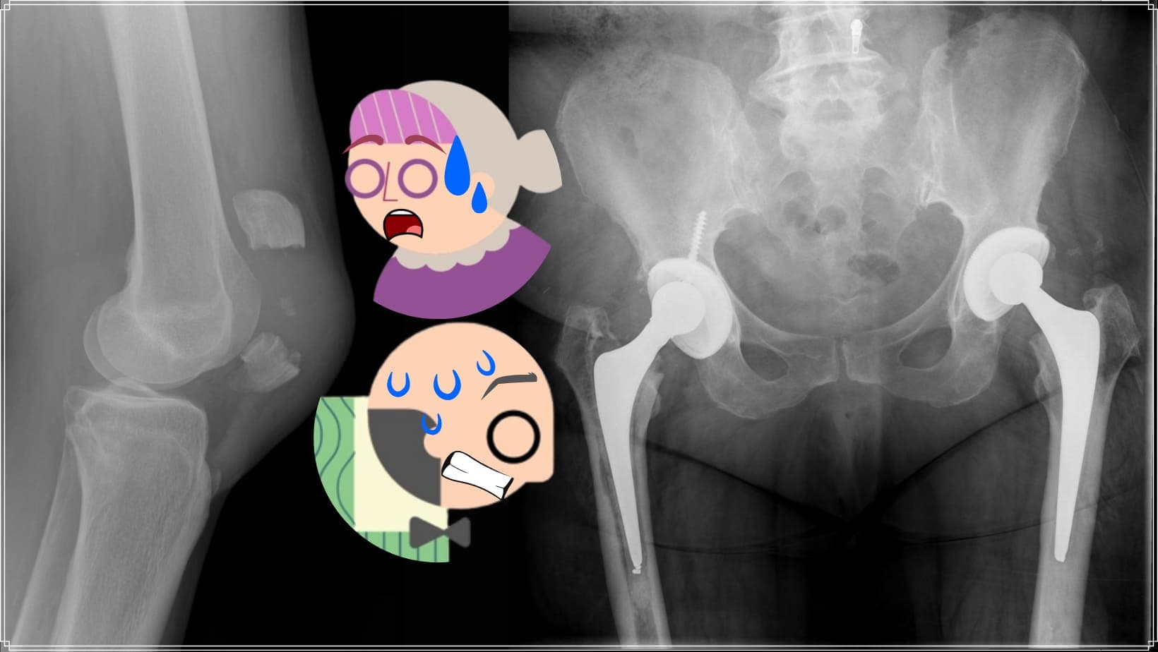 Comment se préparer à une chirurgie de la hanche?